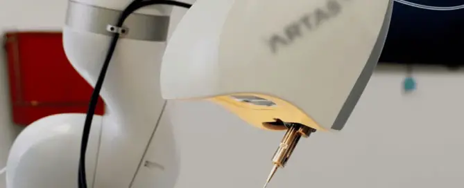 robotic hair transplant