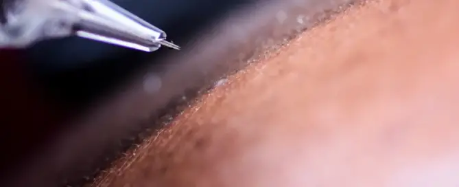 what is scalp micropigmentation