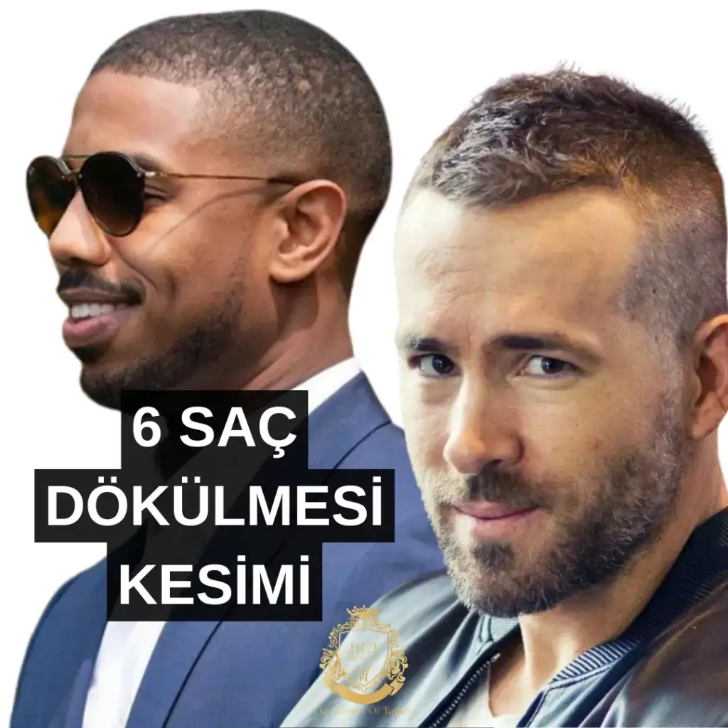 6 Saç Dökülmesi Kesimi