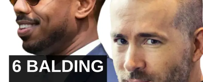 6 balding haircuts