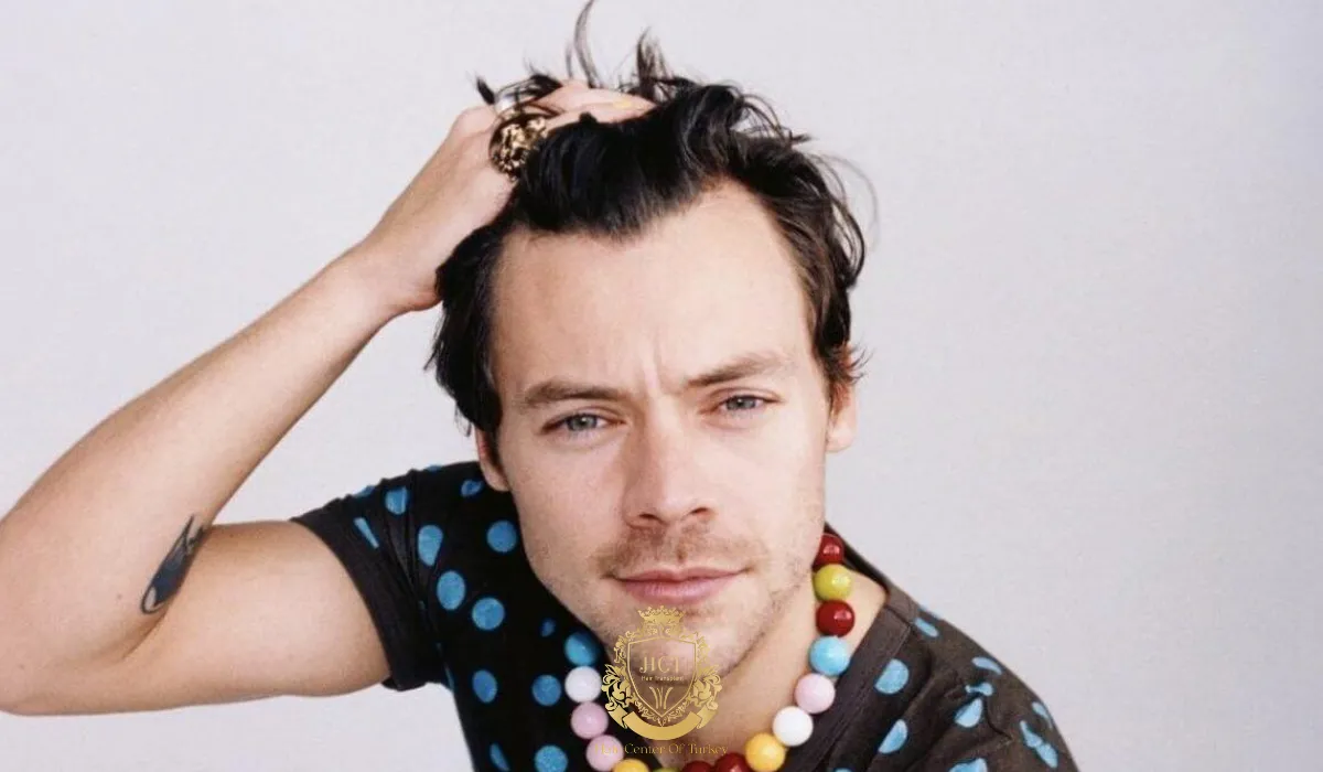 harry styles is bald