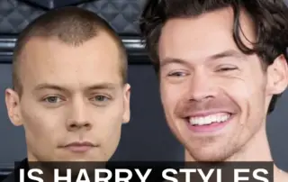 harry styles is bald