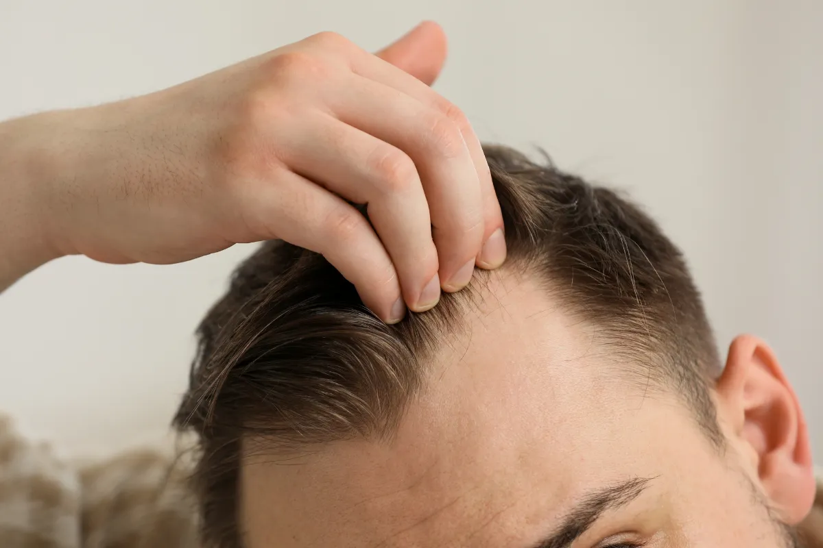 Minoxidil