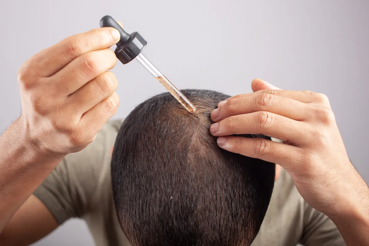 Minoxidil