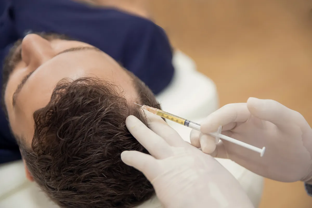 What Happens When a Hair Transplant Fails