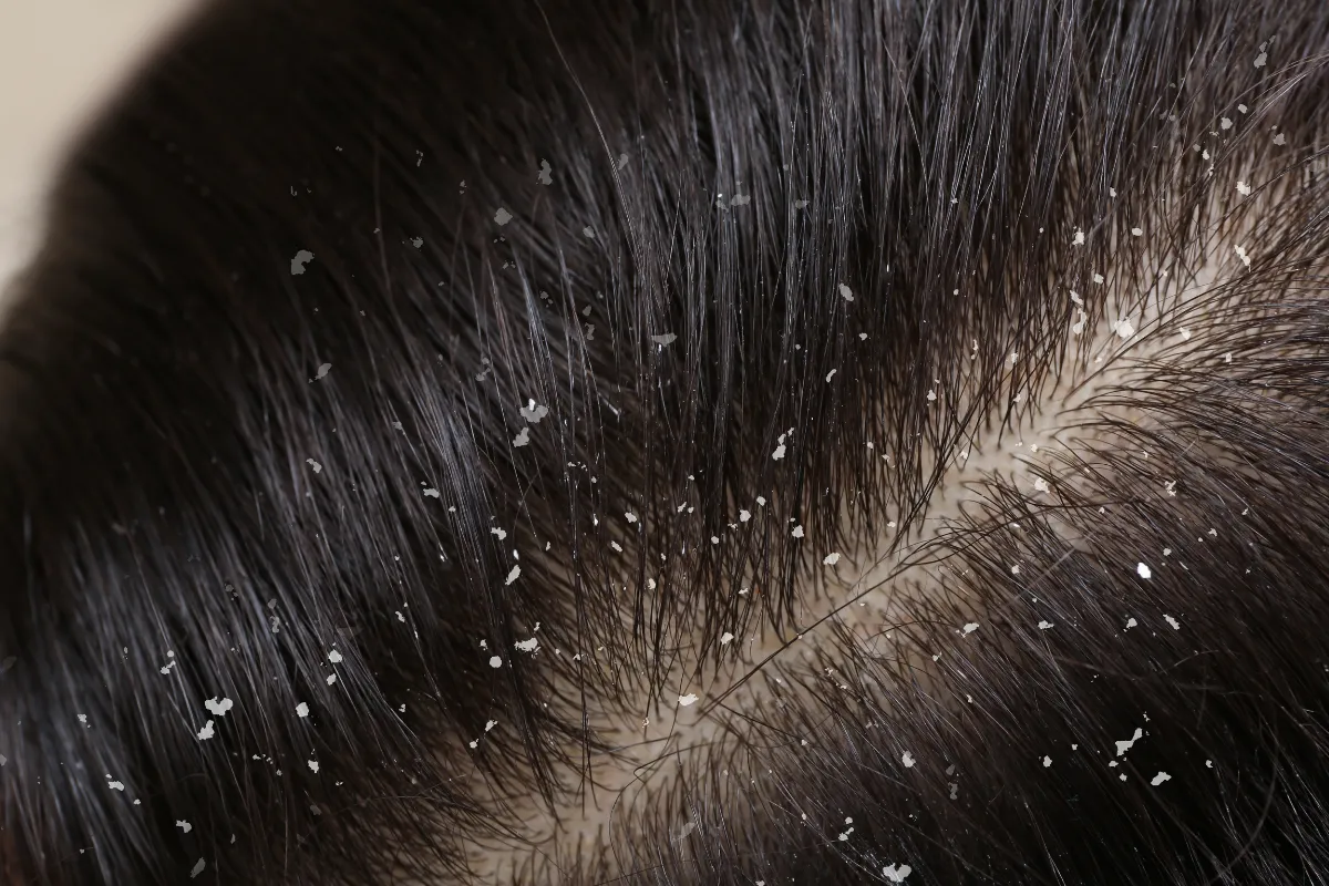 Does Rice Water Really Make Your Hair Grow Faster