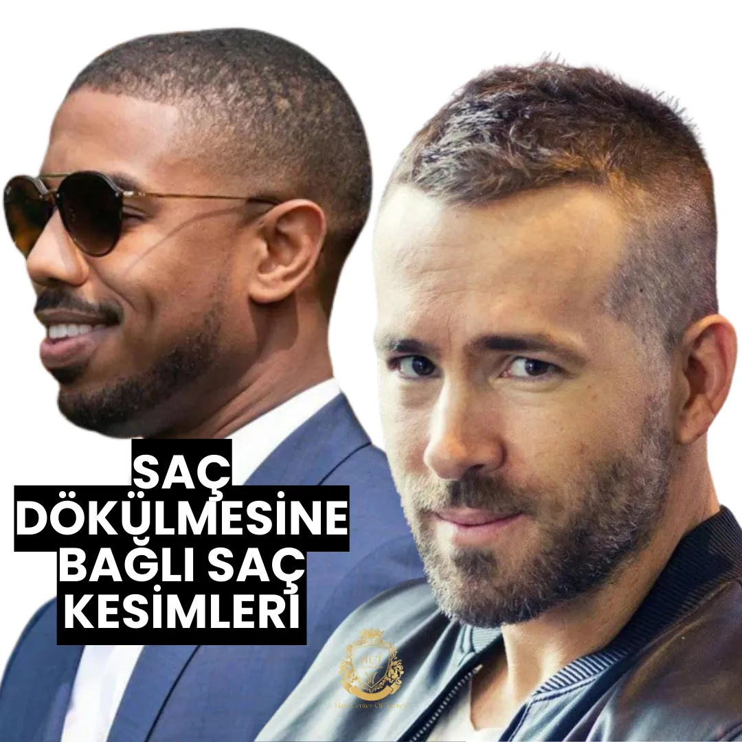 SAÇ DÖKÜLMESİNE BAĞLI SAÇ KESİMLERİ