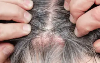 Why Do Hair Roots Hurt