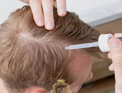 Was ist Minoxidil und wie wirkt es?