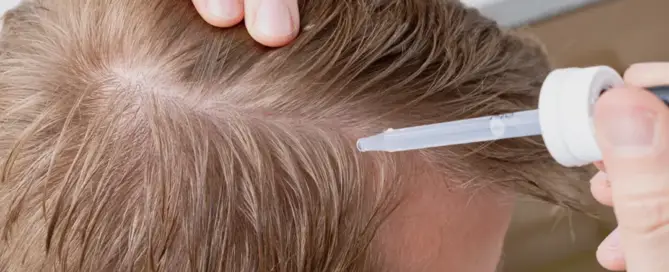Minoxidil