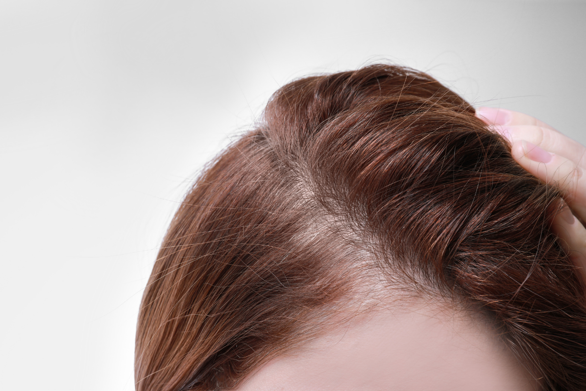 What Are the Best Haircuts for Women with Thinning Hair?