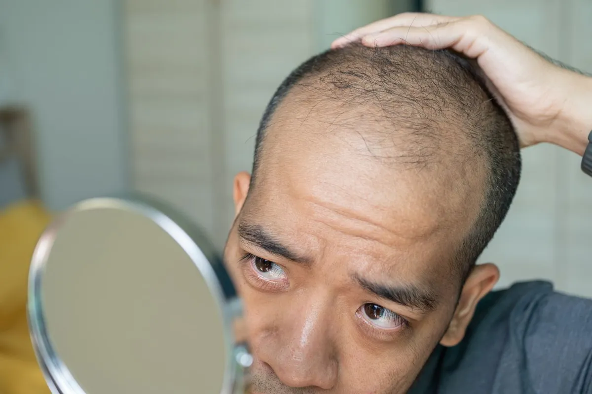 Can People with Physical Disabilities Get a Hair Transplant?