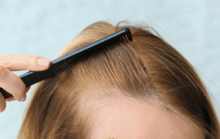 What Are the Best Haircuts for Women with Thinning Hair?