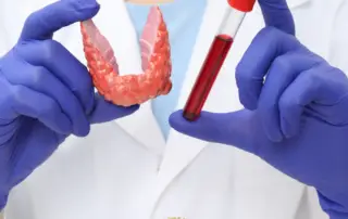 Can People with Thyroid Problems Get a Hair Transplant?