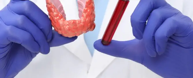 Can People with Thyroid Problems Get a Hair Transplant?