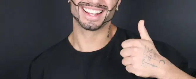 Ideal Candidates for Beard Transplantation F