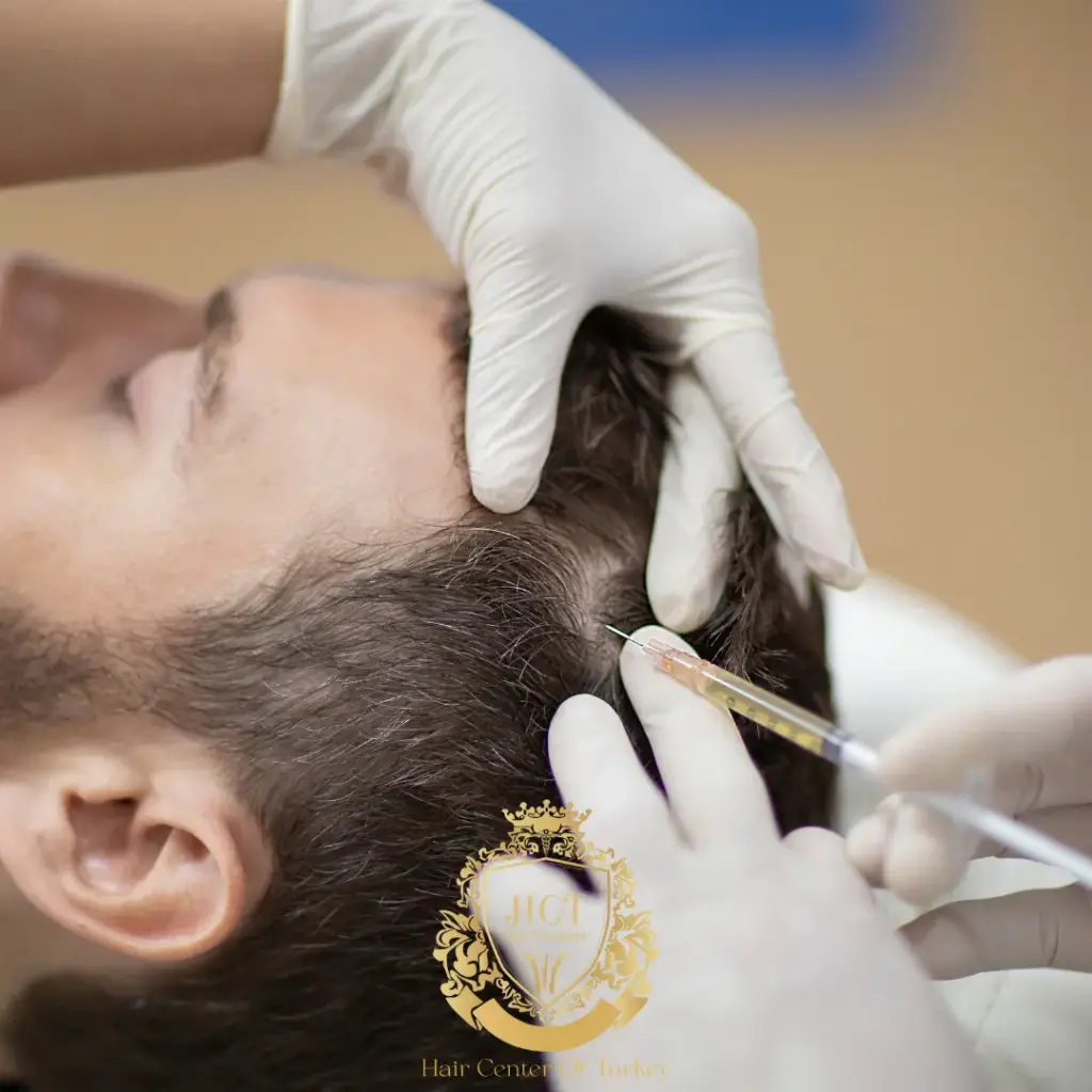 PRP Treatment Combined with Hair Transplantation