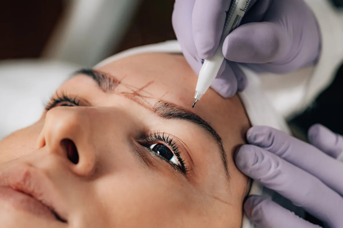 What Is Micro FUE Eyebrow Transplant 2