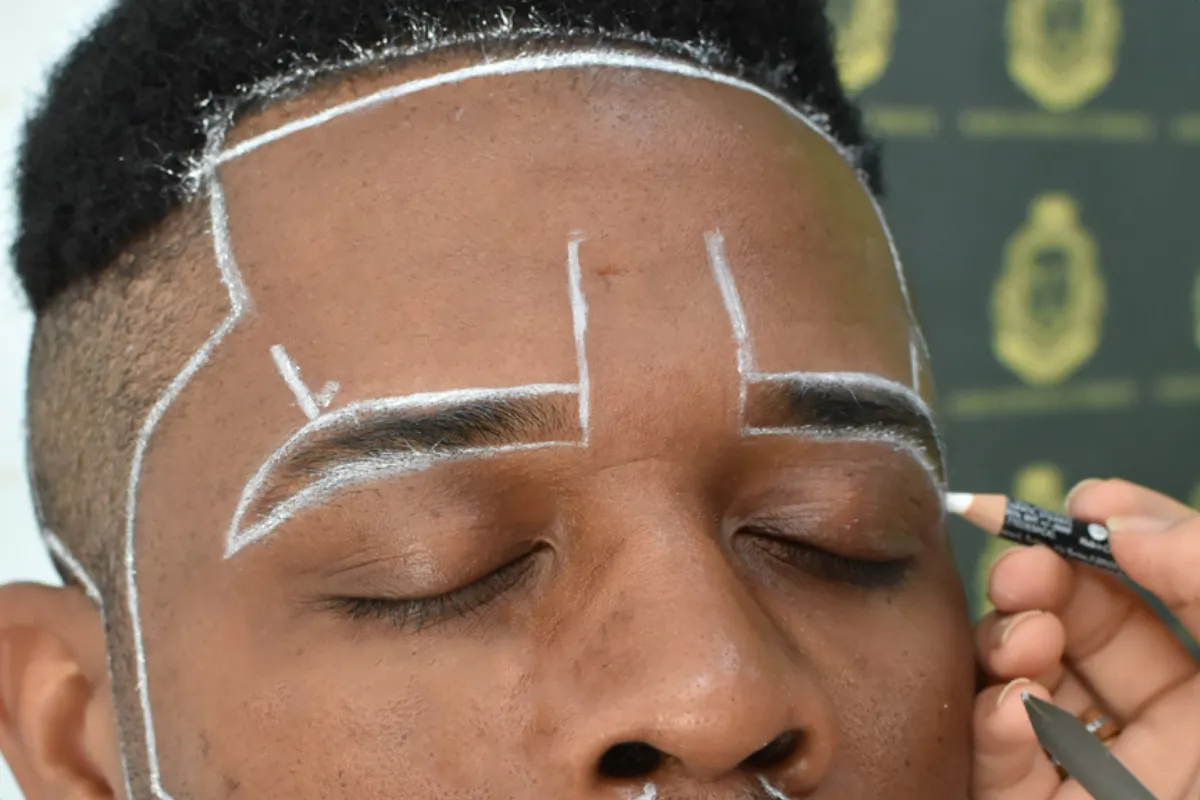 What Is Micro FUE Eyebrow Transplant 3