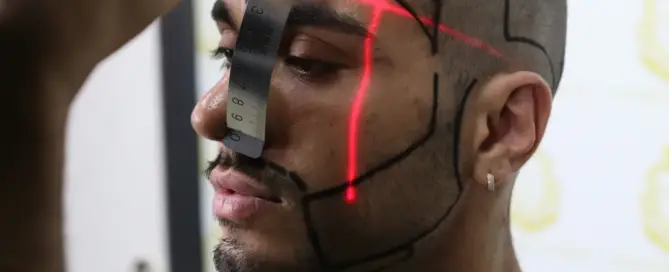 When Is the Best Season for Beard Transplant F