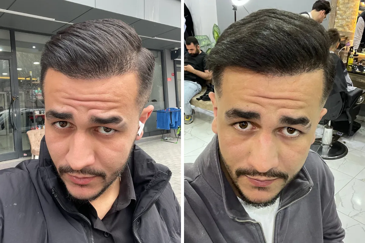 What is good for gray hair