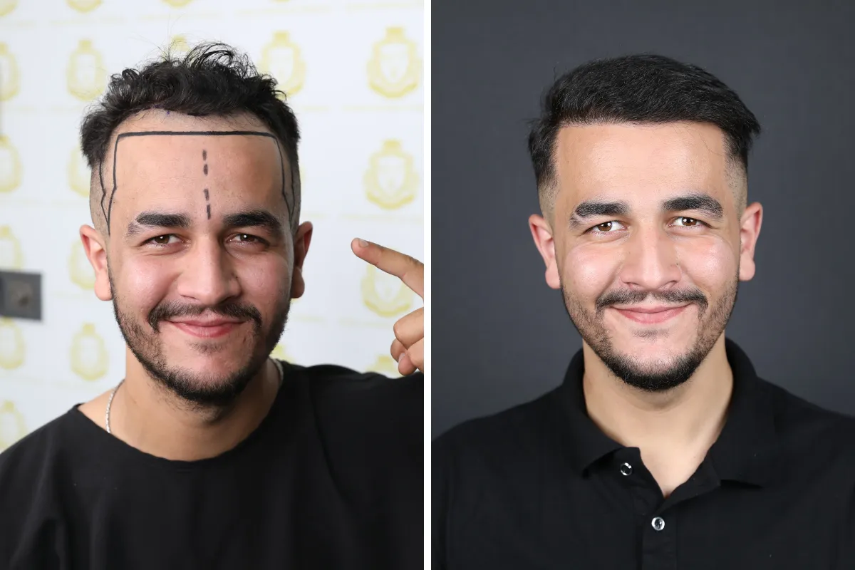 What is good for gray hair