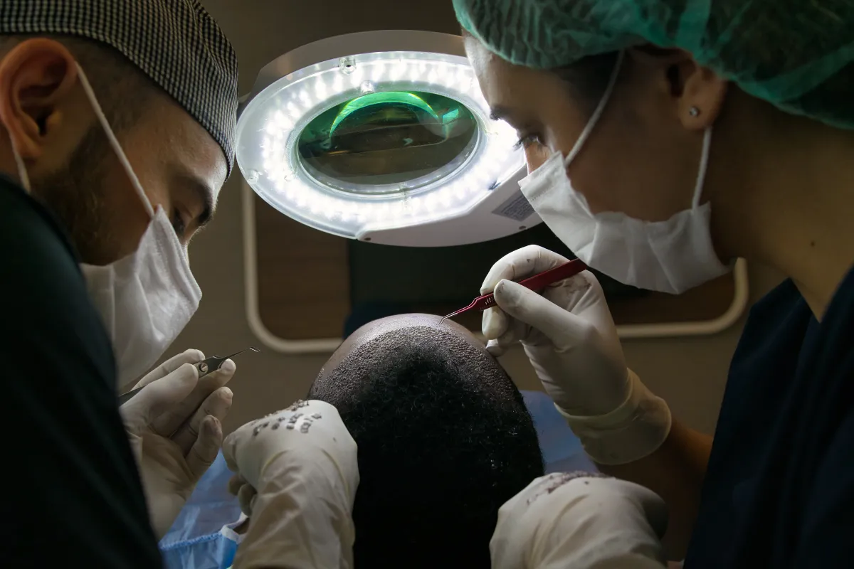 Can Hair Transplants Cause Cancer 2