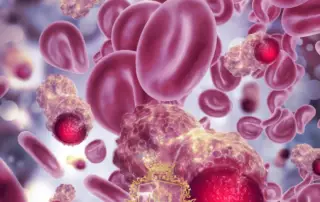 Can Hair Transplants Cause Cancer f