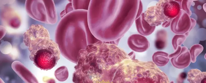 Can Hair Transplants Cause Cancer f
