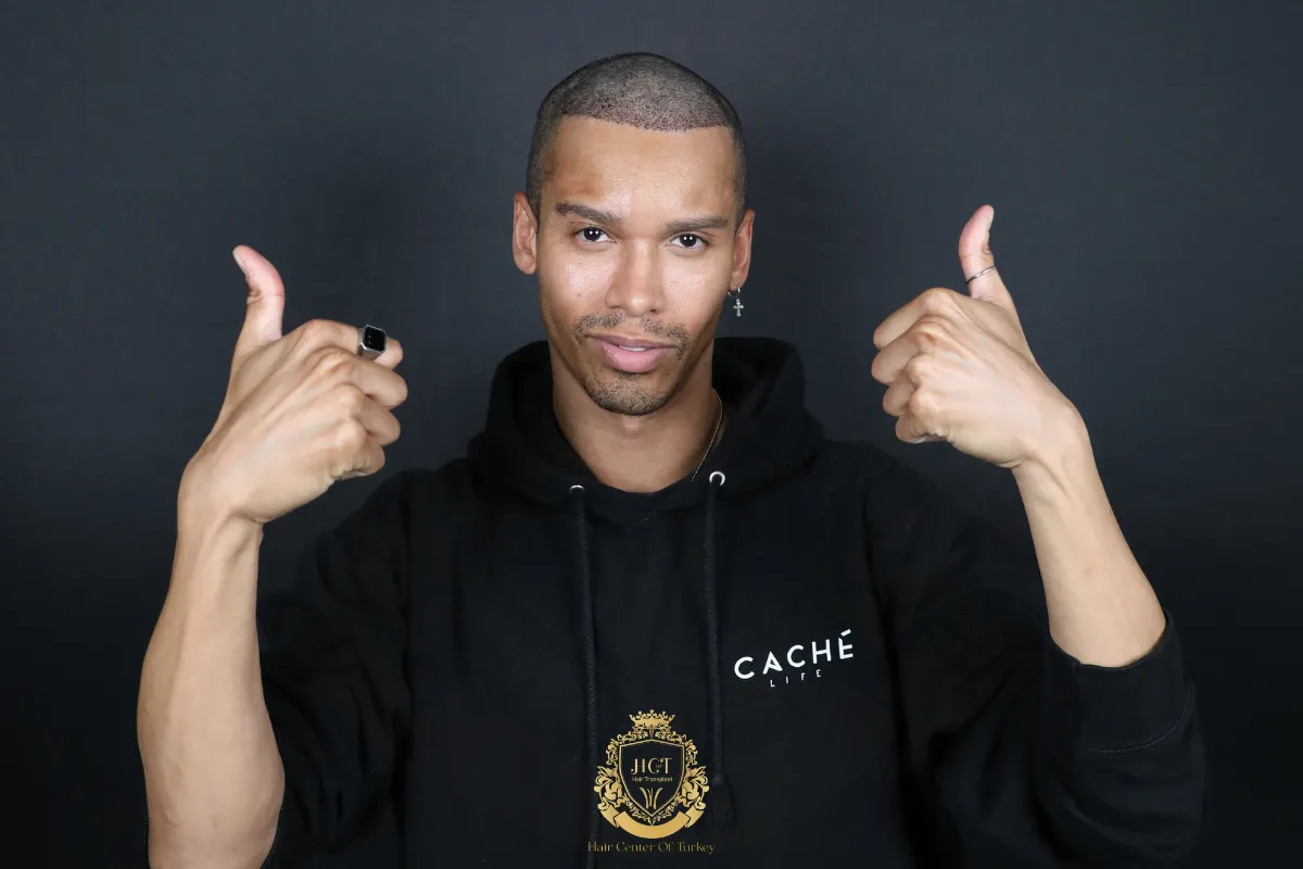 Can I Go To Work After a Hair Transplant 2_result