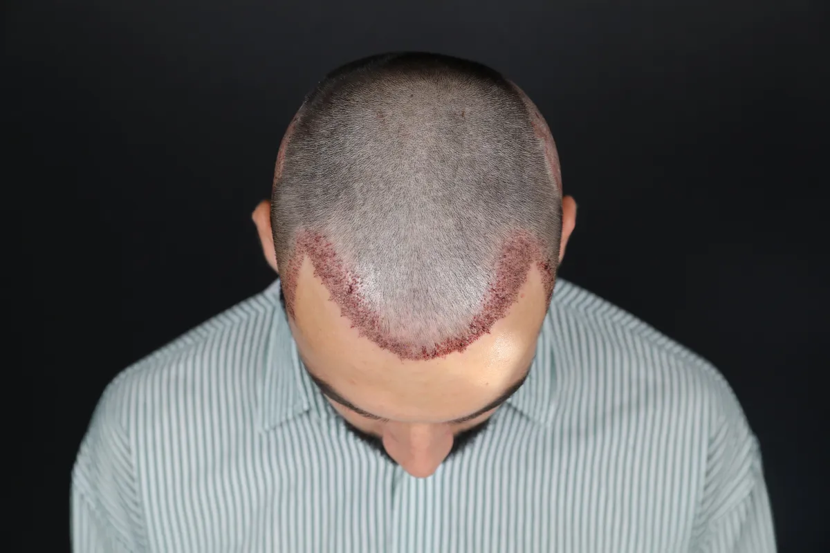 What is good for gray hair