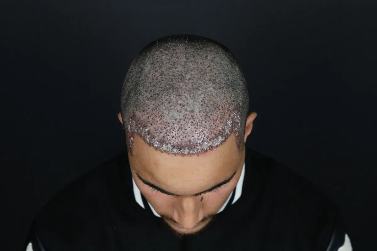 What is good for gray hair