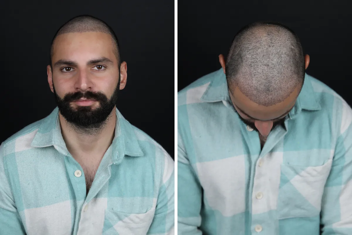 What is good for gray hair