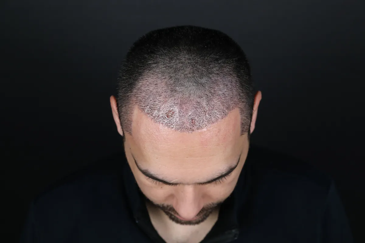 What is good for gray hair