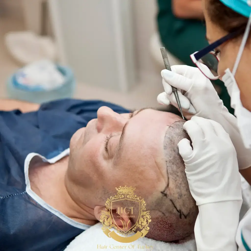 How Can You Maximize FUE Hair Survival Effectively F