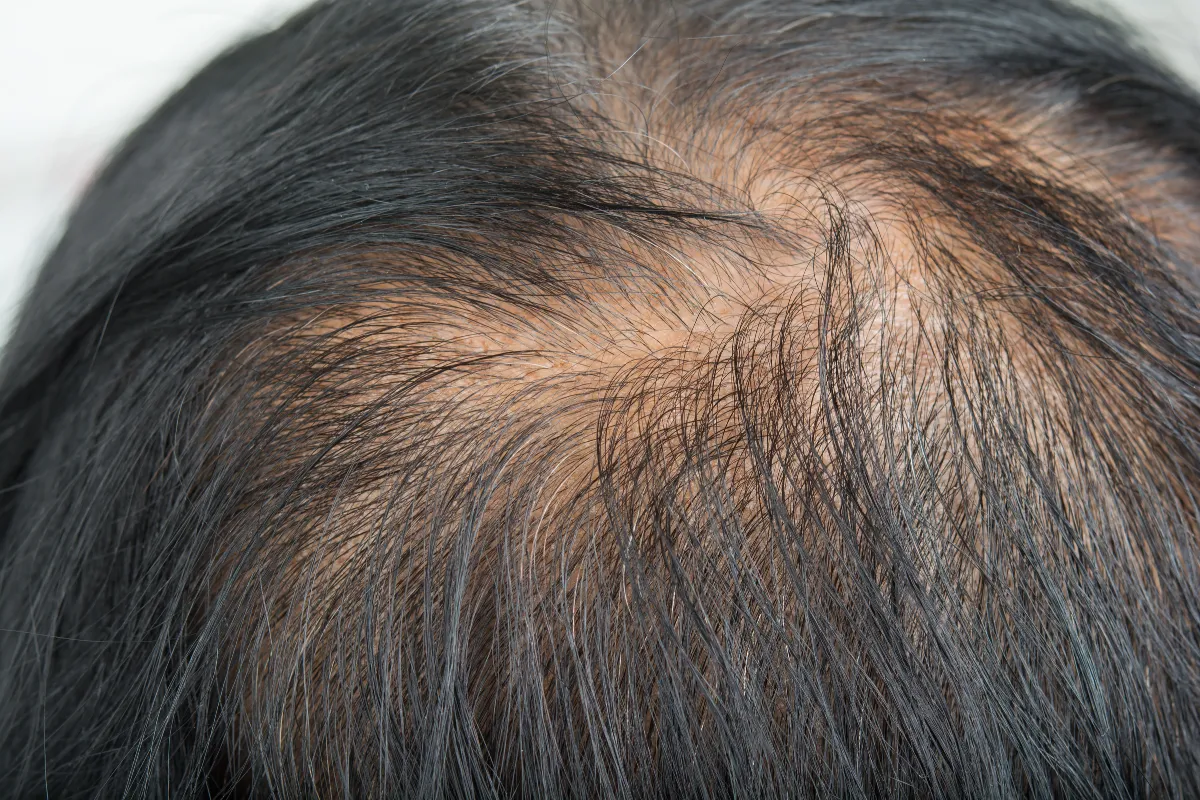 How To Fix Broken Hair 3