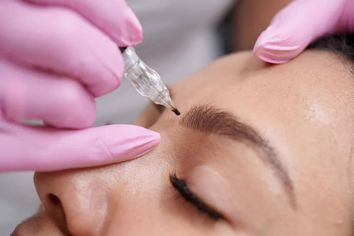 Is Eyebrow Transplant or Microblading Better 1