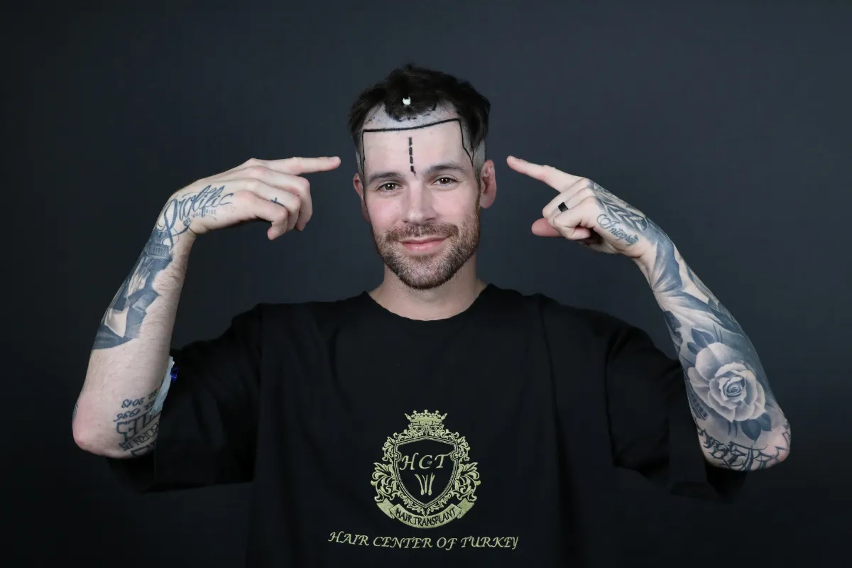 Is Medical Travel Insurance Necessary for a Hair Transplant in Turkey 2