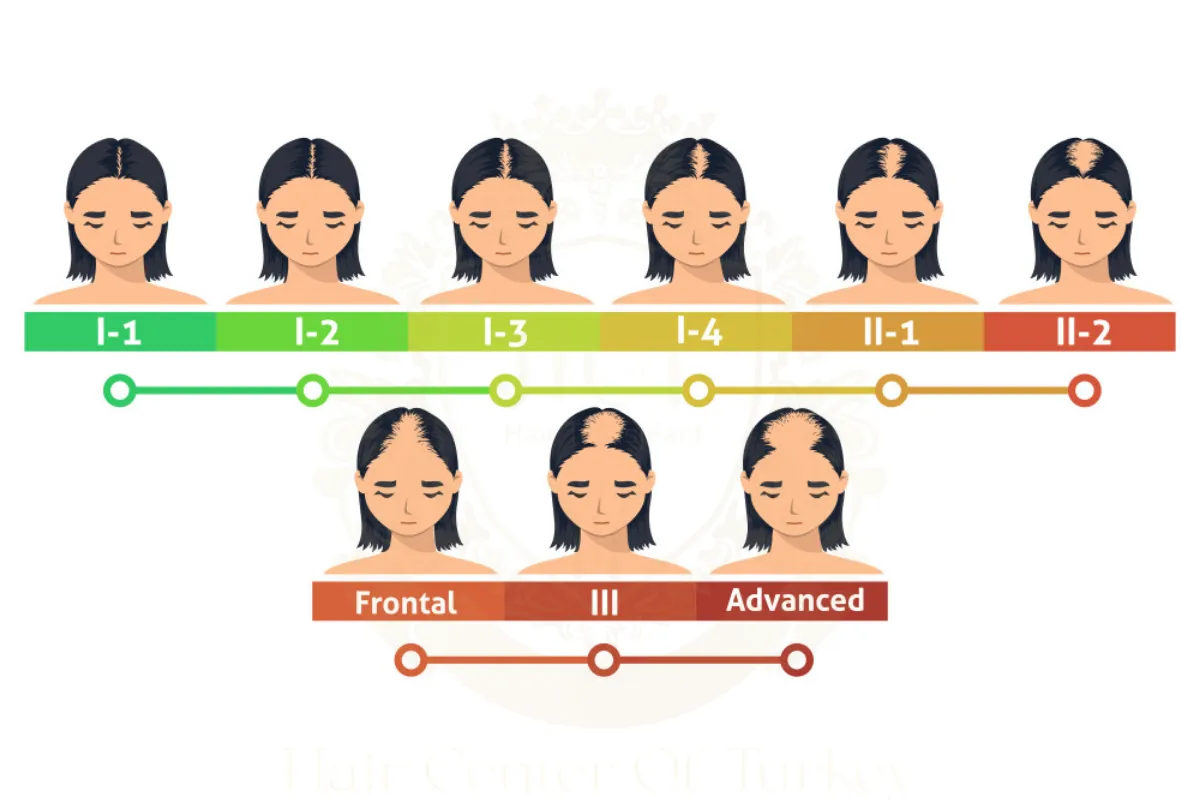 Ludwig Scale 1