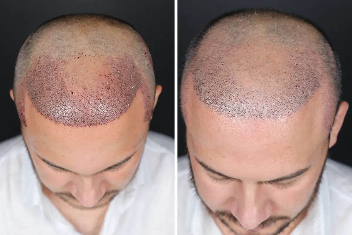 What is good for gray hair