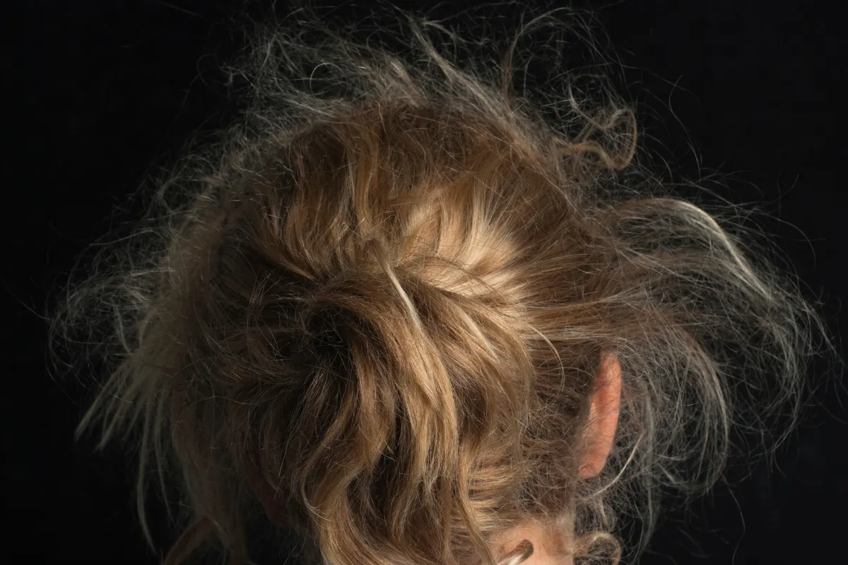 What Are the Most Common Hair Problems and How Can You Fix Them 2