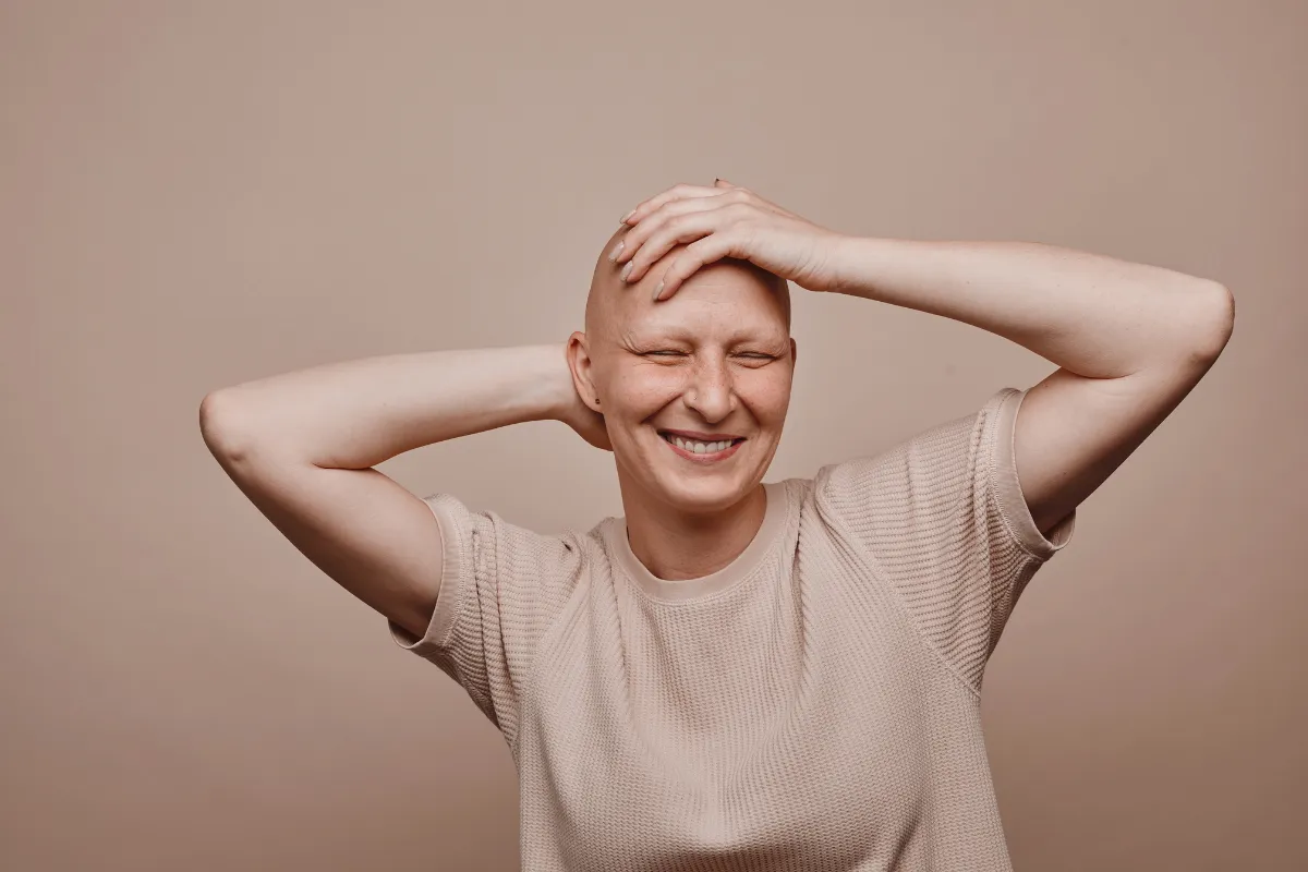 What Is Alopecia Totalis and What Are Its Symptoms and Causes 1