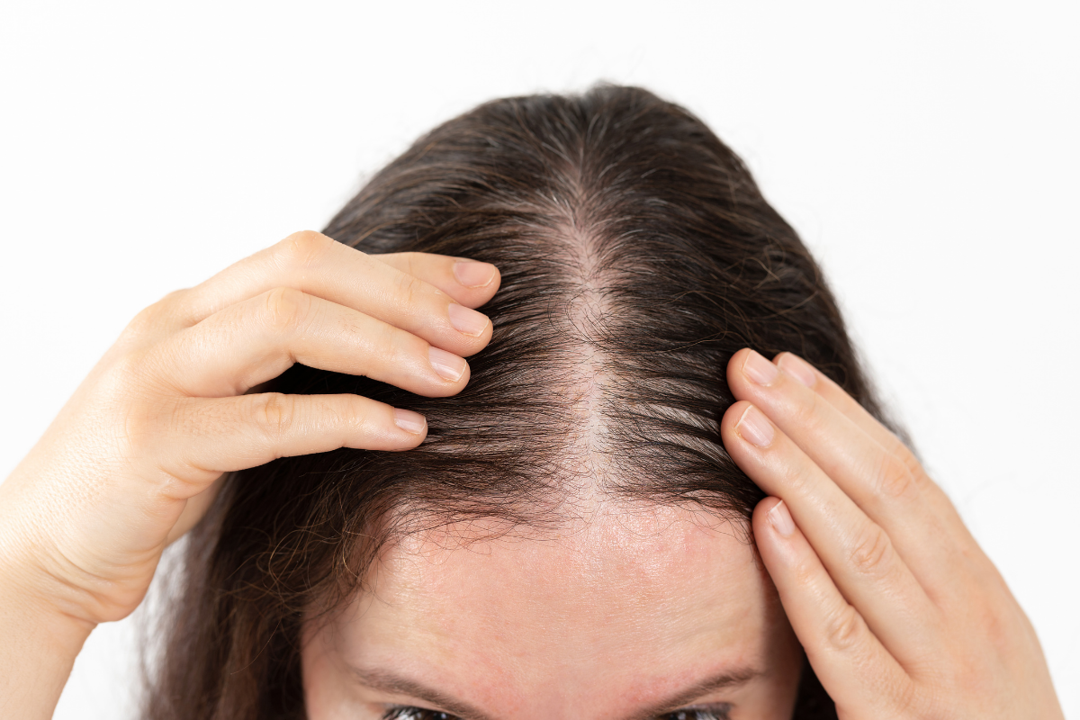What Is the Best Way to Stop Menopause Hair Loss and Regrow Thicker Hair Naturally 2
