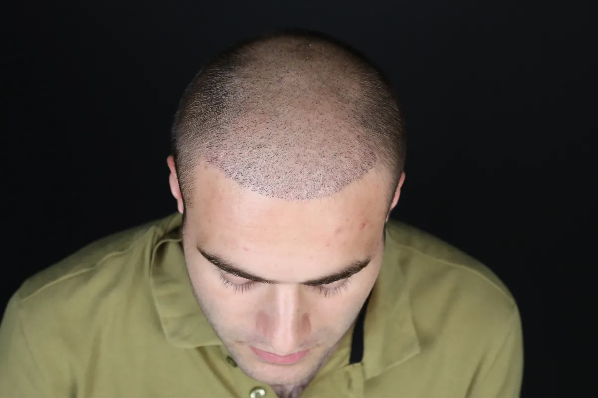 What is good for gray hair