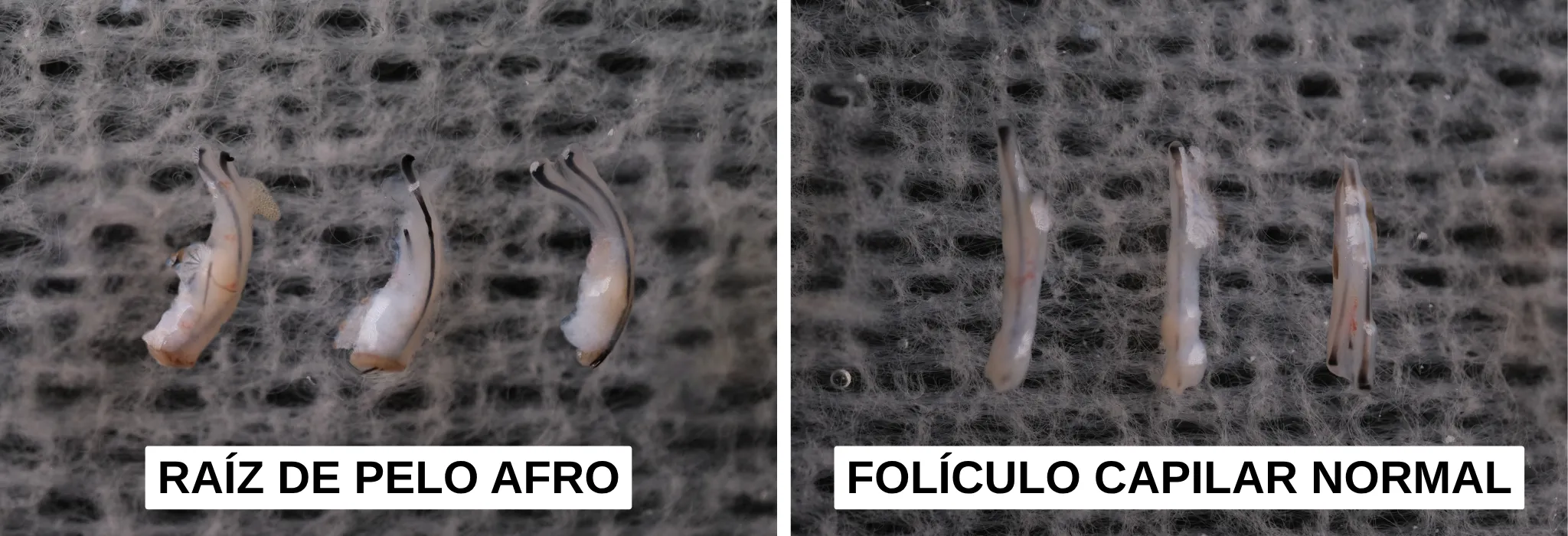 Foliculo piloso afro frente a folículo piloso normal es Foliculo piloso afro frente a folículo piloso normal