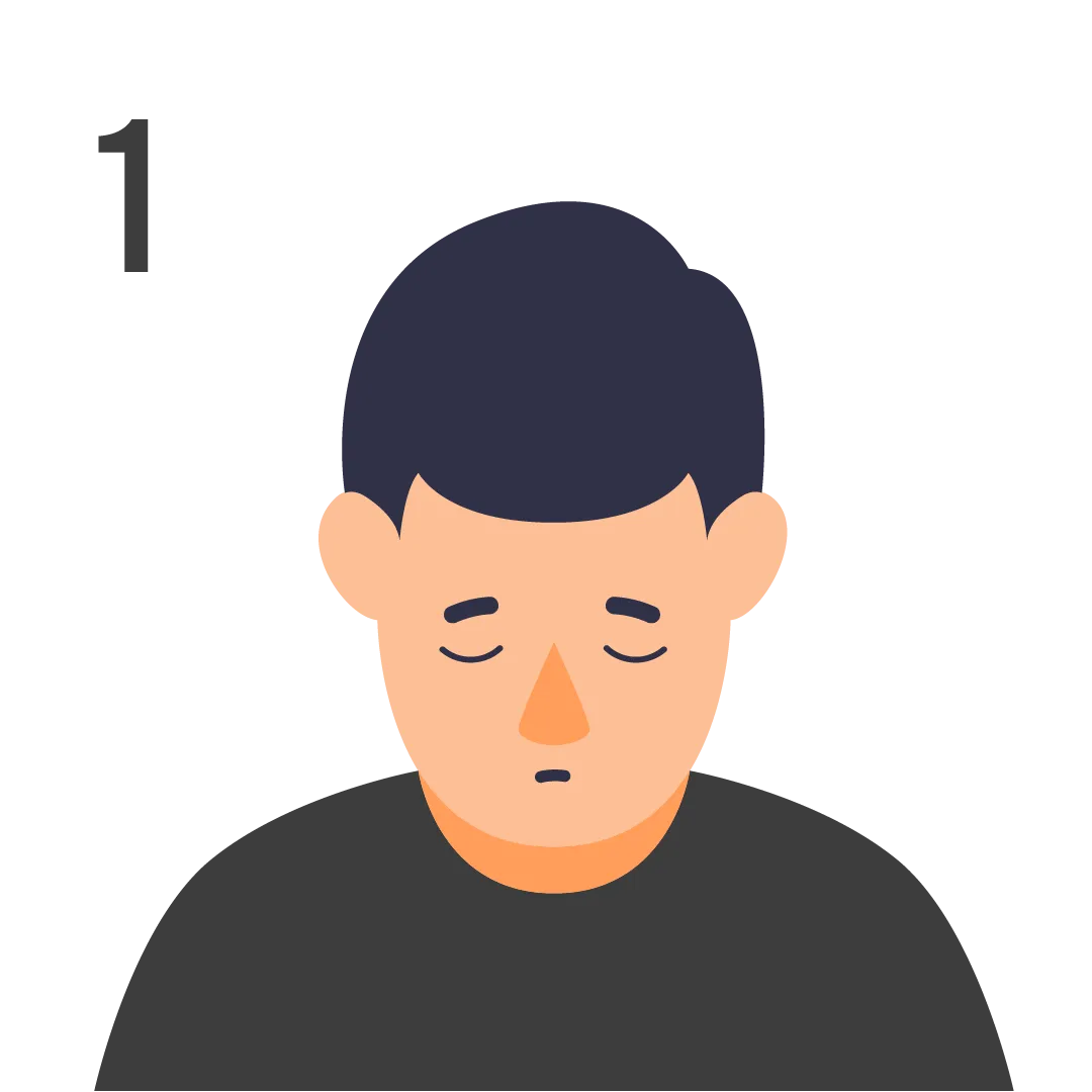 male pattern baldness norwood scale stage 1