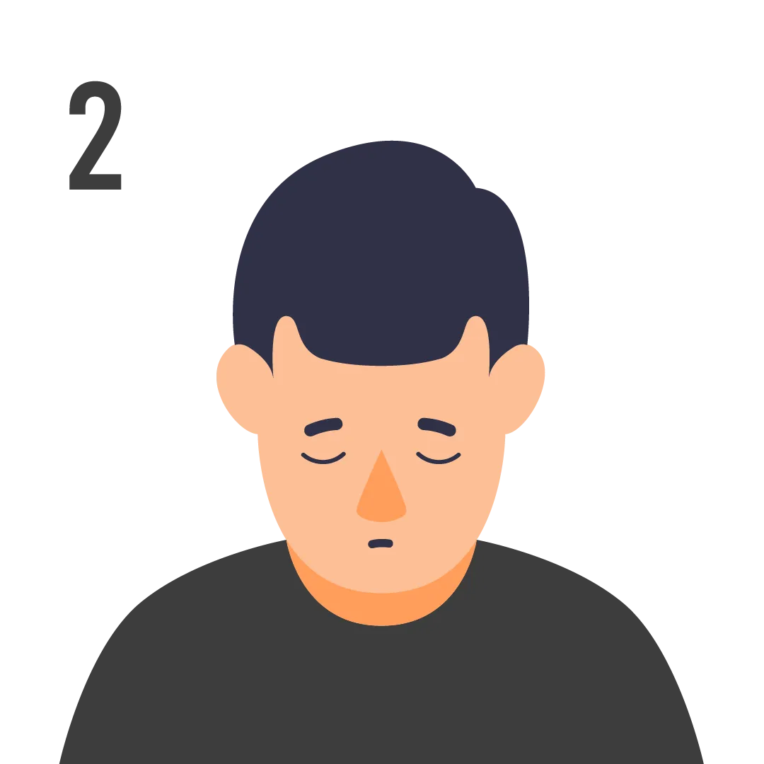 male pattern baldness norwood scale stage 2