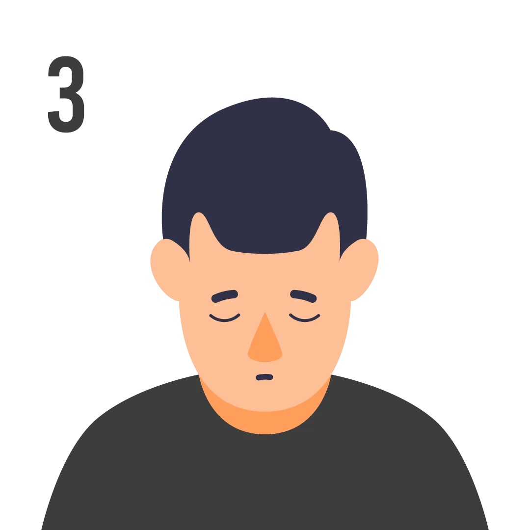 male pattern baldness norwood scale stage 3