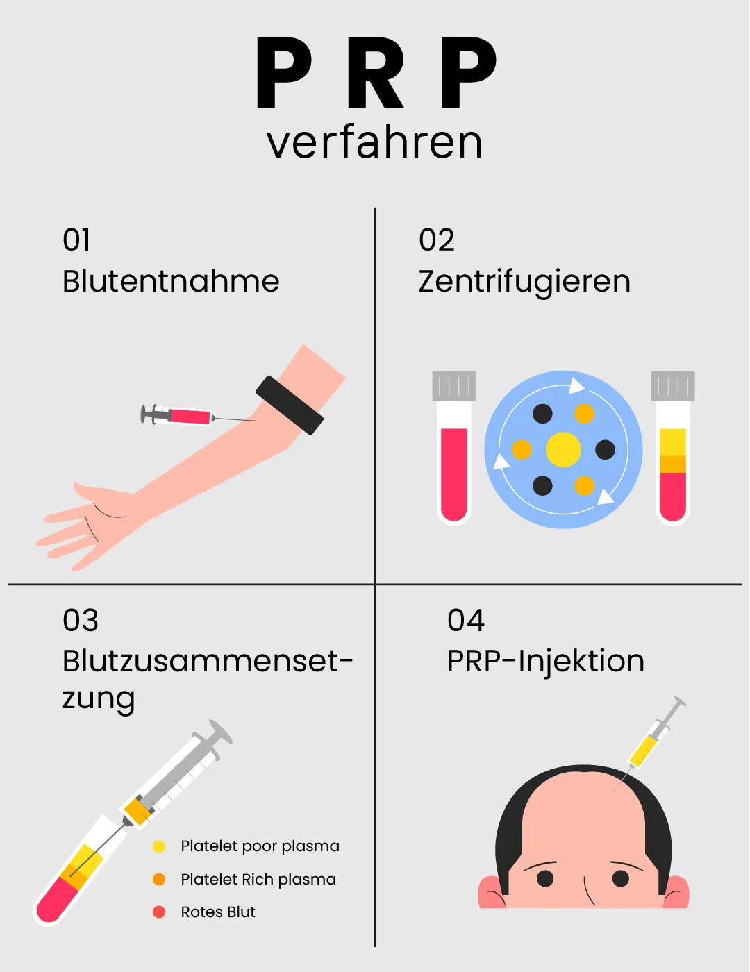 prp procedure de prp procedure