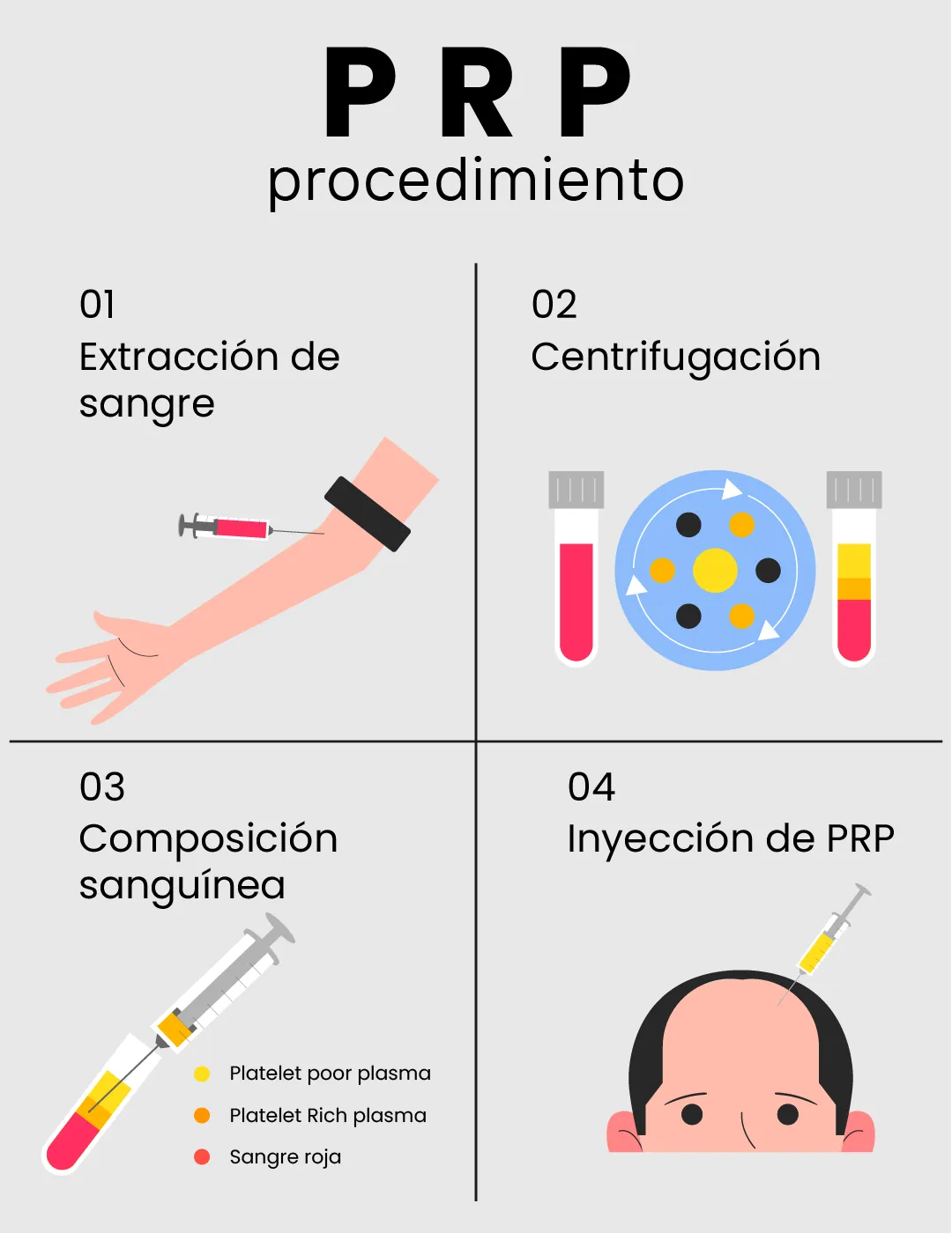 prp procedure 